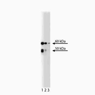 anti-Checkpoint Kinase 2 (CHEK2) (AA 31-234) antibody avatar