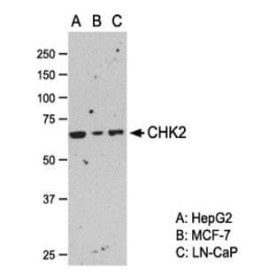 anti-Checkpoint Kinase 2 (CHEK2) antibody avatar