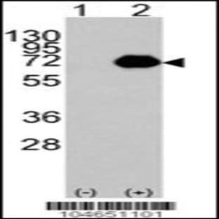 anti-Acyl-CoA Oxidase 1, Palmitoyl (ACOX1) (C-Term), (AA 629-659) antibody avatar