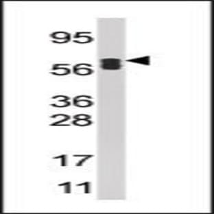 anti-Acyl-CoA Oxidase 1, Palmitoyl (ACOX1) (N-Term) antibody avatar