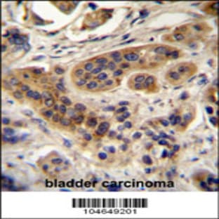 anti-Acyl-CoA Oxidase 1, Palmitoyl (ACOX1) (N-Term), (AA 7-37) antibody avatar