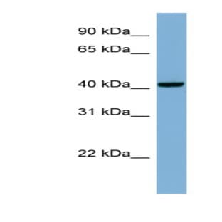 anti-Pleckstrin Homology Domain Containing, Family A (Phosphoinositide Binding Specific) Member 9 (PLEKHA9) (Middle Region) antibody avatar