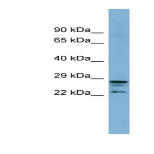 anti-CutC Copper Transporter Homolog (E. Coli) (CUTC) (Middle Region) antibody avatar