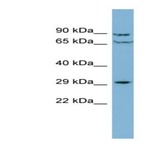 anti-CutC Copper Transporter Homolog (E. Coli) (CUTC) (Middle Region) antibody avatar