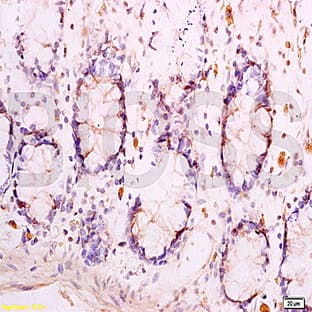 anti-Adiponectin Receptor 1 (ADIPOR1) antibody avatar