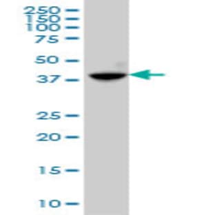 anti-Abhydrolase Domain Containing 5 (ABHD5) (AA 240-343) antibody avatar