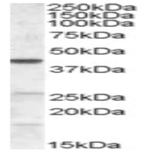 anti-Abhydrolase Domain Containing 5 (ABHD5) (Internal Region) antibody avatar