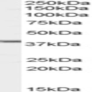 anti-Abhydrolase Domain Containing 5 (ABHD5) (Internal Region) antibody avatar