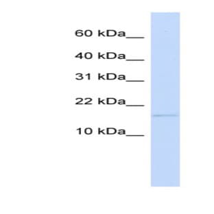 anti-Chromosome 3 Open Reading Frame 18 (C3orf18) (N-Term) antibody avatar