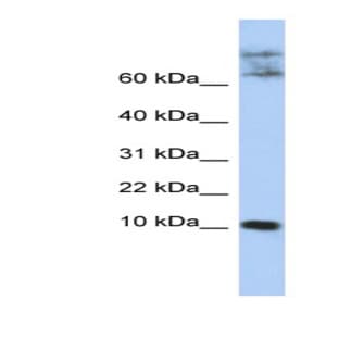 anti-Chemokine-Like Factor (CKLF) (N-Term) antibody avatar