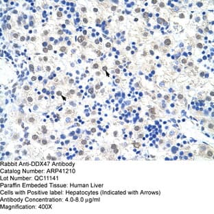 anti-DEAD (Asp-Glu-Ala-Asp) Box Polypeptide 47 (DDX47) (C-Term) antibody avatar