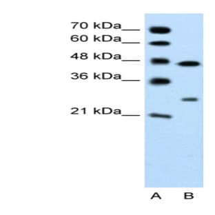 anti-Claudin 18 (CLDN18) (C-Term) antibody avatar