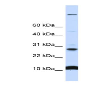 anti-Chromosome 19 Open Reading Frame 56 (C19orf56) (N-Term) antibody avatar