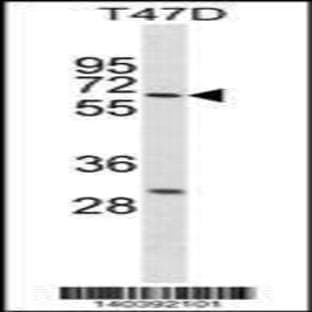 anti-DEAD (Asp-Glu-Ala-Asp) Box Polypeptide 41 (DDX41) (N-Term), (AA 141-169) antibody avatar