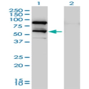 anti-DEAD (Asp-Glu-Ala-Asp) Box Polypeptide 41 (DDX41) (AA 523-623) antibody avatar