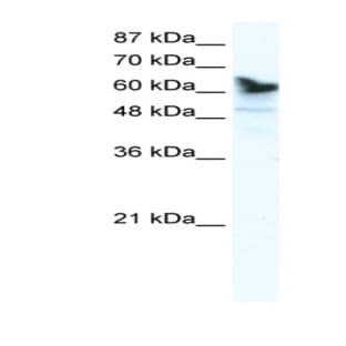 anti-DEAD (Asp-Glu-Ala-Asp) Box Polypeptide 41 (DDX41) (C-Term) antibody avatar