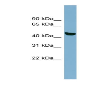 anti-Chromosome 22 Open Reading Frame 28 (C22orf28) (N-Term) antibody avatar