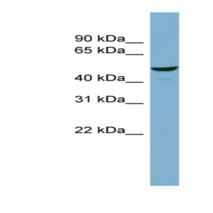 anti-Chromosome 22 Open Reading Frame 28 (C22orf28) (Middle Region) antibody avatar