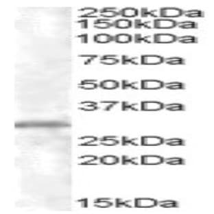 anti-Charged Multivesicular Body Protein 5 (CHMP5) (C-Term) antibody avatar
