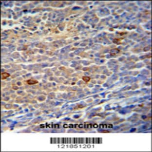 anti-Chromosome 9 Open Reading Frame 156 (C9orf156) (C-Term), (AA 365-391) antibody avatar