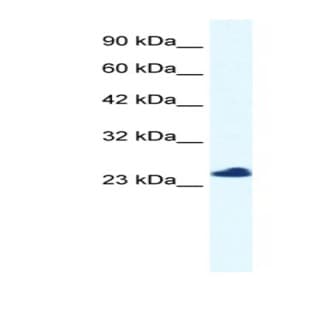 anti-Chromosome 14 Open Reading Frame 166 (C14orf166) (N-Term) antibody avatar