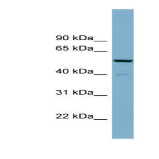 anti-CDK5 Regulatory Subunit Associated Protein 1 (CDK5RAP1) (N-Term) antibody avatar