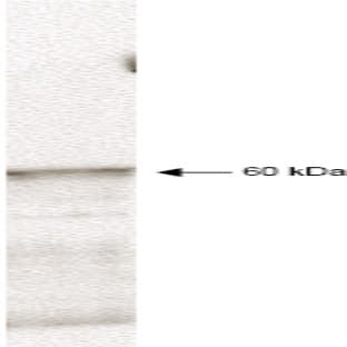 anti-3-phosphoinositide Dependent Protein Kinase-1 (PDPK1) (AA 301-312) antibody avatar