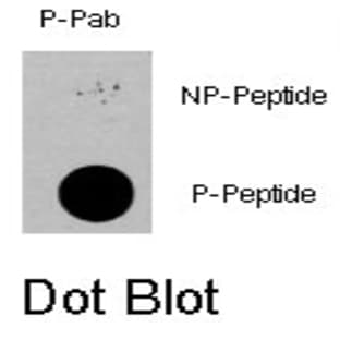 anti-3-phosphoinositide Dependent Protein Kinase-1 (PDPK1) (pSer396) antibody avatar