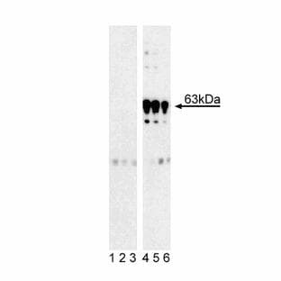 anti-3-phosphoinositide Dependent Protein Kinase-1 (PDPK1) (pSer241) antibody avatar