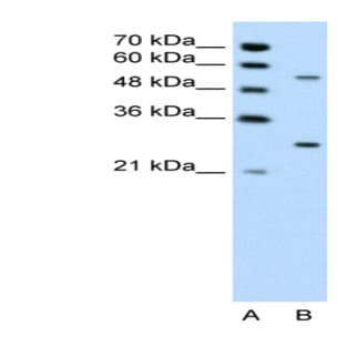 anti-3-phosphoinositide Dependent Protein Kinase-1 (PDPK1) (Middle Region) antibody avatar