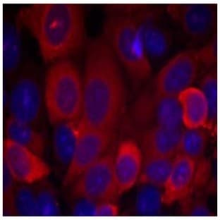 anti-3-phosphoinositide Dependent Protein Kinase-1 (PDPK1) (Ser241) antibody avatar