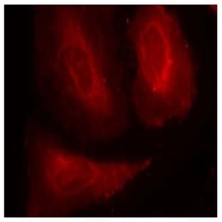 anti-3-phosphoinositide Dependent Protein Kinase-1 (PDPK1) (pSer241) antibody avatar