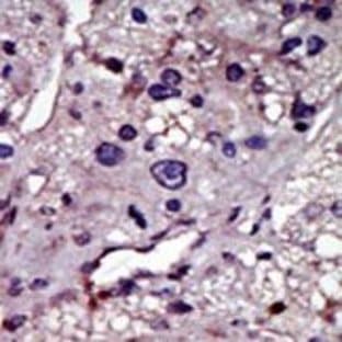 anti-Cytidine Monophosphate (UMP-CMP) Kinase 1, Cytosolic (CMPK1) (N-Term) antibody avatar