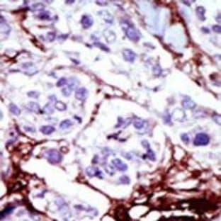 anti-Cytidine Monophosphate (UMP-CMP) Kinase 1, Cytosolic (CMPK1) (C-Term) antibody avatar