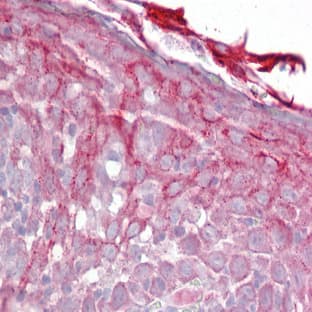 anti-Complement Factor P (CFP) (N-Term) antibody avatar