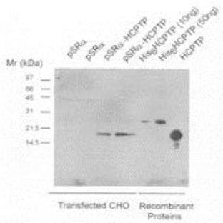 anti-Acid Phosphatase 1, Soluble (ACP1) antibody avatar