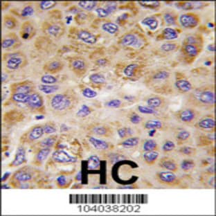 anti-6-phosphofructo-2-Kinase/fructose-2,6-Biphosphatase 1 (PFKFB1) (Middle Region) antibody