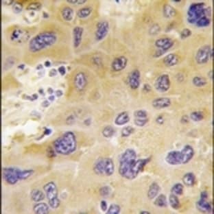 anti-6-phosphofructo-2-Kinase/fructose-2,6-Biphosphatase 1 (PFKFB1) (N-Term) antibody