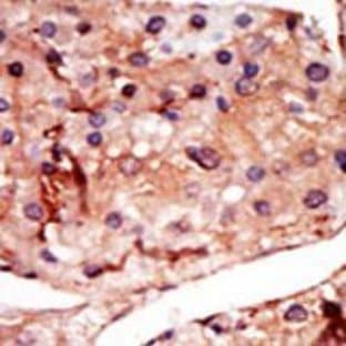 anti-6-phosphofructo-2-Kinase/fructose-2,6-Biphosphatase 2 (PFKFB2) (N-Term) antibody avatar