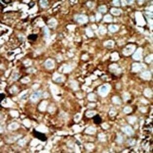 anti-6-phosphofructo-2-Kinase/fructose-2,6-Biphosphatase 3 (PFKFB3) (C-Term) antibody avatar