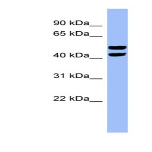 anti-6-phosphofructo-2-Kinase/fructose-2,6-Biphosphatase 4 (PFKFB4) (N-Term) antibody avatar