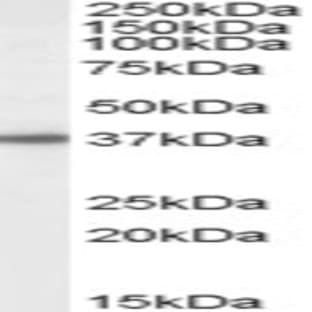 anti-3'(2'), 5'-Bisphosphate Nucleotidase 1 (BPNT1) (C-Term) antibody avatar