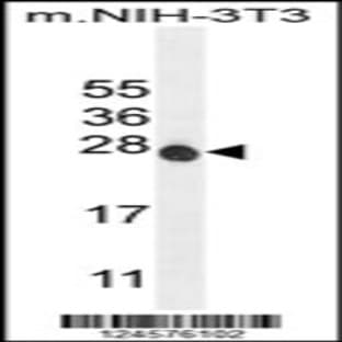 anti-ATPase, H+ Transporting, Lysosomal 16kDa, V0 Subunit C (ATP6V0C) (C-Term), (AA 100-126) antibody avatar