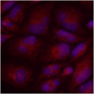 anti-PKM2 (AA 1-531), (N-Term) antibody avatar
