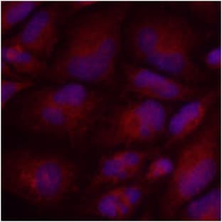 anti-PKM2 (AA 1-531), (N-Term) antibody avatar