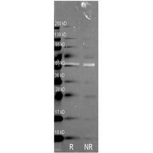 anti-Catalase (CAT) antibody avatar