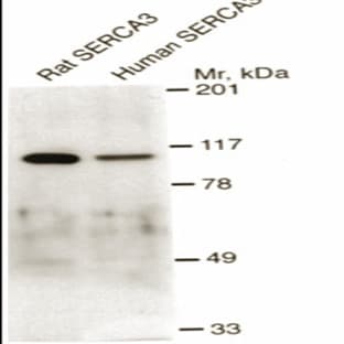 anti-ATPase, Ca++ Transporting, Ubiquitous (ATP2A3) (AA 29-39) antibody avatar