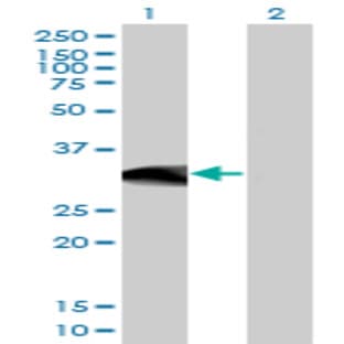 anti-B-Cell CLL/lymphoma 11A (Zinc Finger Protein) (BCL11A) (AA 1-89) antibody avatar