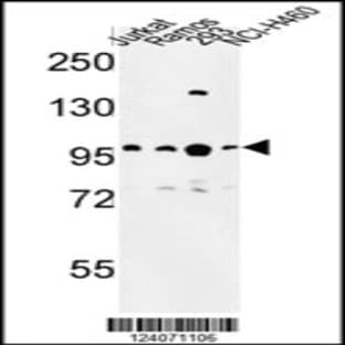 anti-B-Cell CLL/lymphoma 11A (Zinc Finger Protein) (BCL11A) (C-Term), (AA 806-835) antibody avatar