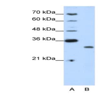 anti-CPX Chromosome Region, Candidate 1 (CPXCR1) (N-Term) antibody avatar